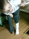 Mason shows off his new plaster cast.