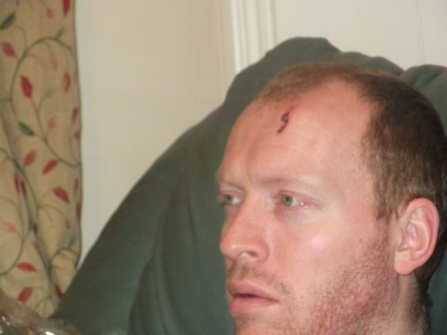 'Harry Potter' Munnings.