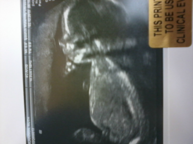 Our baby boy at twenty weeks.